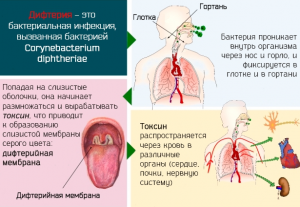 2-ой инцидент заболевания дифтерией в Украине